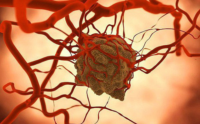 Giám đốc Bệnh viện K: Tế bào ung thư rất 